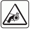 Amputation hazard from belts